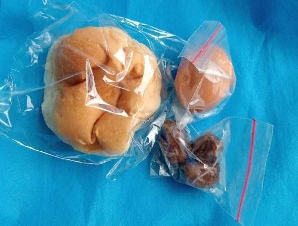 Menu MBG DI Salah Satu Sekolah di Kabupaten Gowa Selama Ramadan (Dok: Ist).