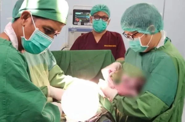 Operasi persalinan caesar yang dilakukan tim medis Sulsel di Aceh (dok. Ist)