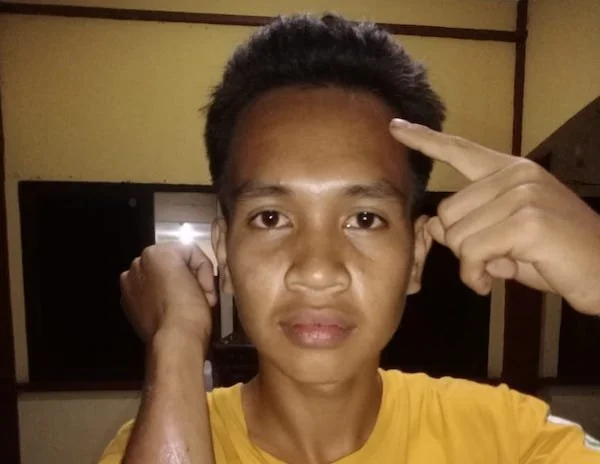 Korban Penganiayaan (Foto : Dok. KabarMakassar).