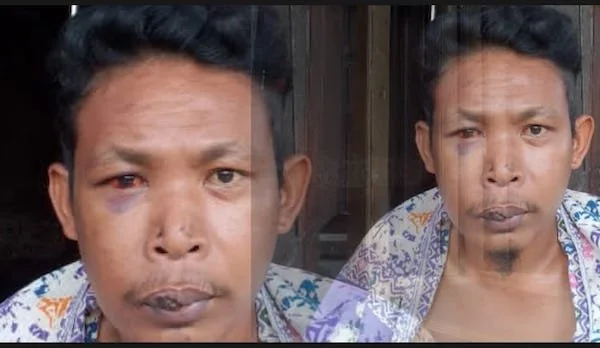 Sampara, warga Dusun Manrumpa,Turatea Timur, Kecamatan Tamalatea, Kabupaten Jeneponto, Sulawesi Selatan (Sulsel), menjadi korban pengeroyokan oleh sejumlah Orang Tak Dikenal (OTK). (Ist).