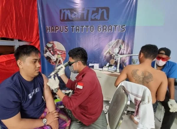Yayasan Mahtan Hadirkan Hapus Tato Gratis di Makassar